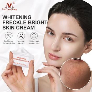 Увлажняющий крем для лица, средство от акне, удаляет темные пятна, отбеливающий крем для светлой кожи, подтягивающий кожу лица, укрепляющий уход за кожей лица